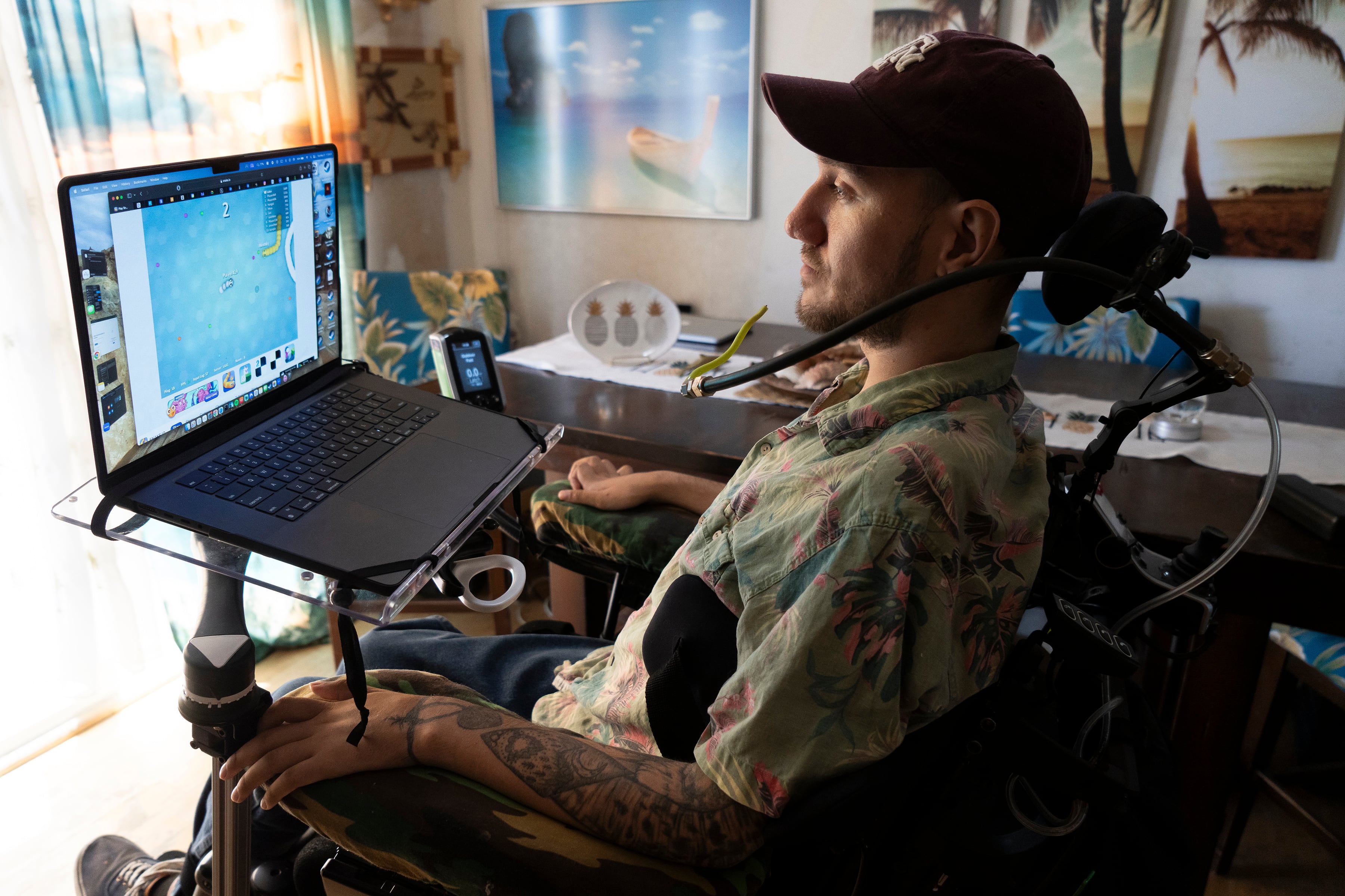 Experiencia Única: Primer Paciente de Neuralink Revela Resultados del Chip Cerebral de Elon Musk